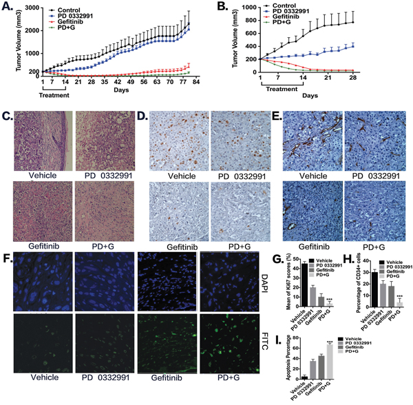 Combination of PD 0332991 and gefitinib treatment in PC-9/AB2 lung cancer xenografts.