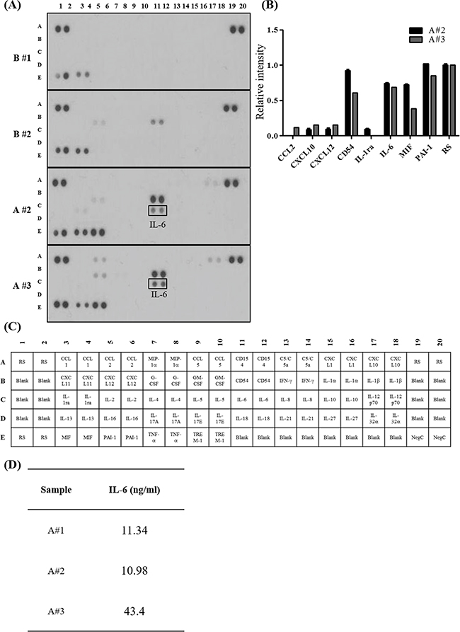 Pro-inflammatory cytokines enriched in ovarian cancer patient derived ascites.