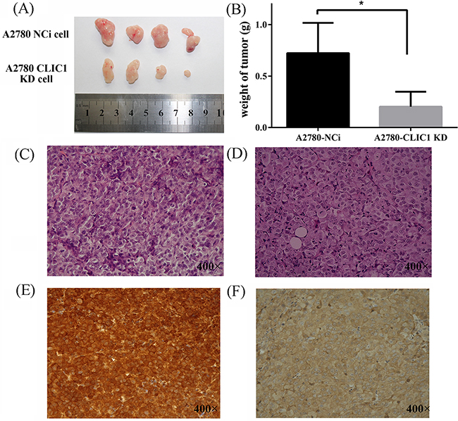 CLIC1 knockdown slows down the tumor growth in vivo in nude mice.