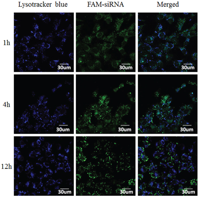 Confocal images of intracellular trafficking of the complexes and lysosome on MCF-7 cells.