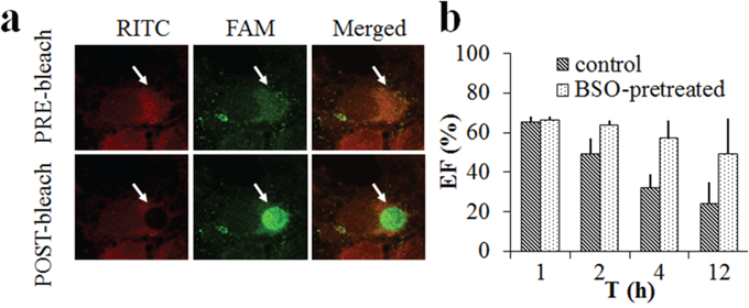 FRET images on the MCF-7 cells incubated with RITC-labelled CS-ss-SA/FAM-siRNA complexes.