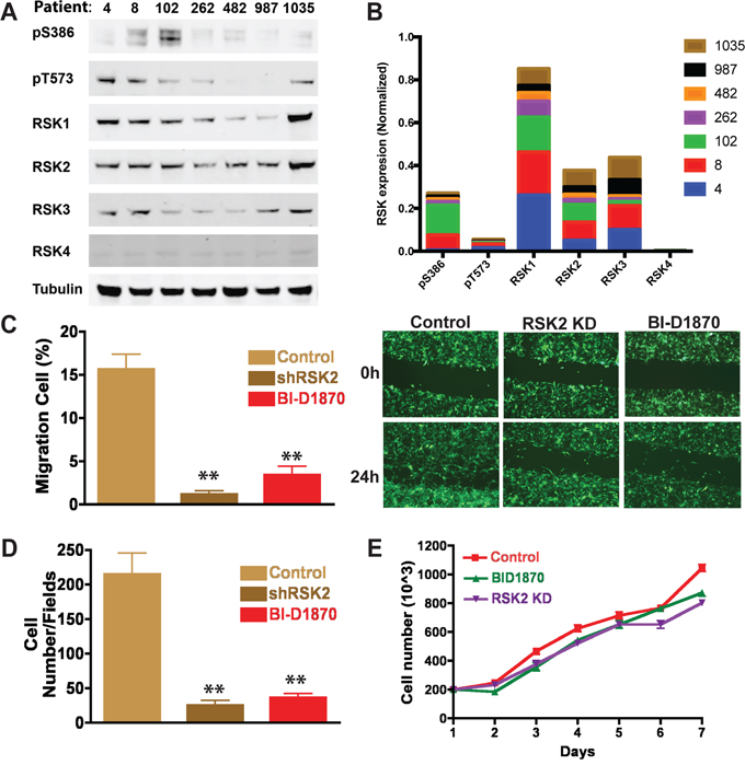 Patient-derived GBM cells require RSK2 for invasion and migration.