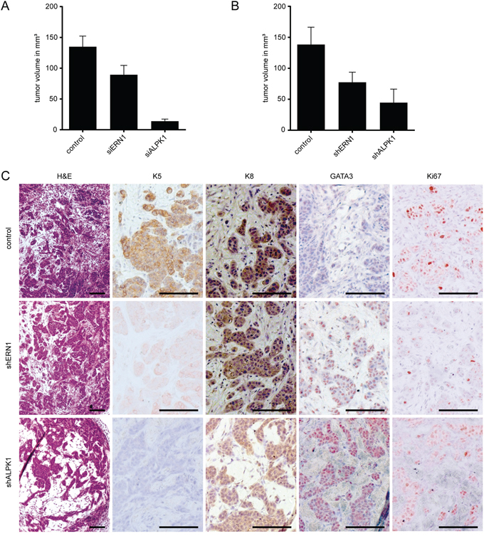 Early ERN1 and ALPK1 knockdown tumors differ in expression pattern or phenotype from control tumors.