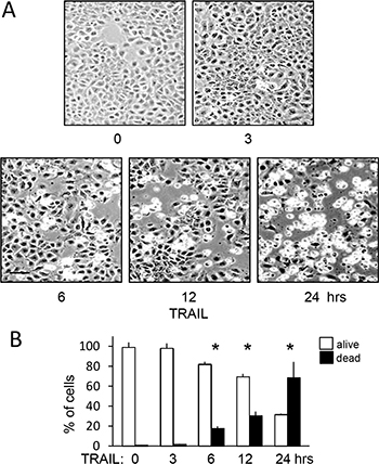 TRAIL induces delayed and not immediate apoptosis of TrkAIII SH-SY5Y cells.