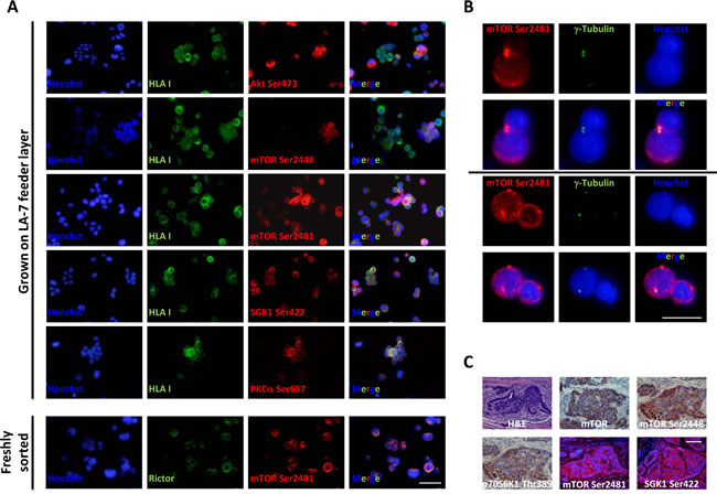 Expression of mTORC1/2 pathway components in CoCSC-derived cultures and xenografts.