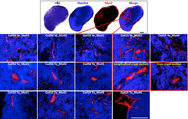 Torin-1 does not affect the survival of normal colon stem cells in vivo.