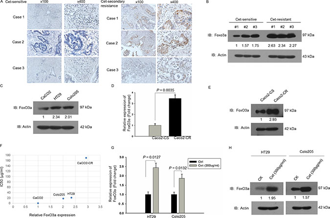 Up-regulated FoxO3a expression in cetuximab resistant RAS WT CRC.