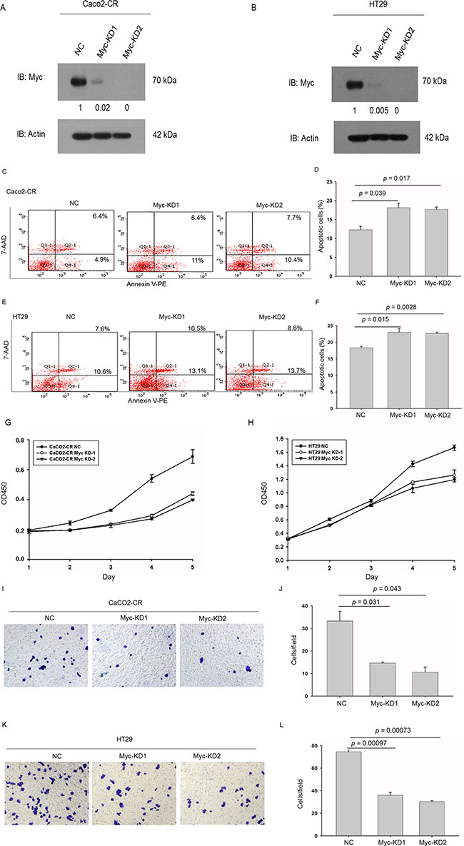 Knockdown of c-Myc sensitized CRC-CR cells to cetuximab treatment and inhibited cell proliferation and migration ability in cetuximab resistant CRC cells.
