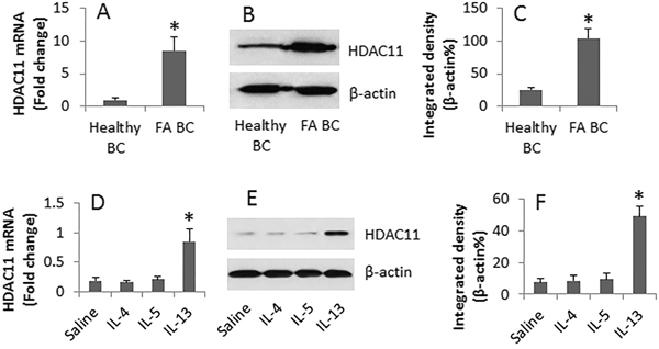 IL-13 increases HDAC11 in B cells.
