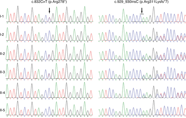 Sequencing results of the TYR gene.