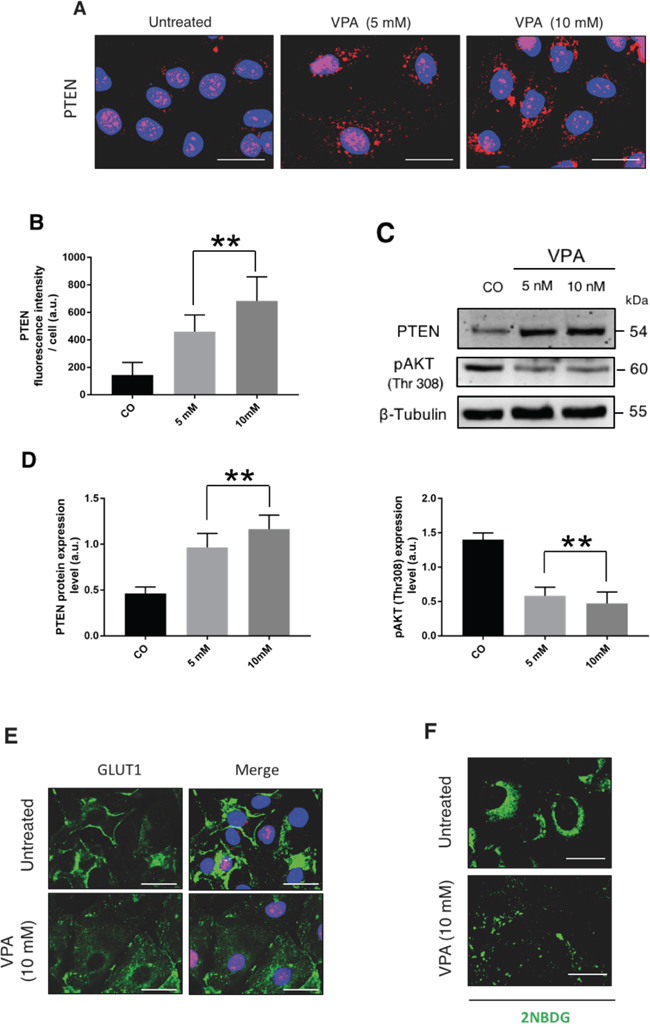 Epigenetic re-expression of PTEN antagonizes glucose uptake in OAW42.