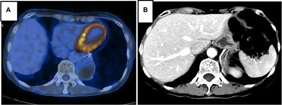 Figure 6: