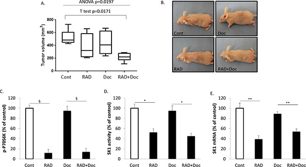 RAD001 sensitizes human prostate tumors established in nude mice to docetaxel.