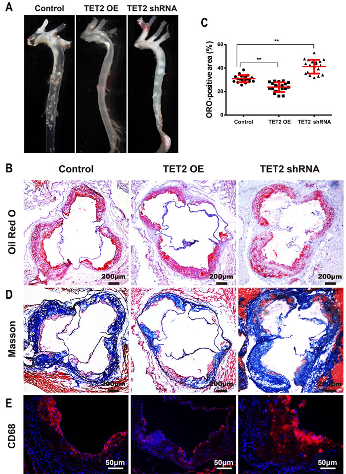 TET2 inhibited the atherosclerotic lesion progression of high fat-fed ApoE