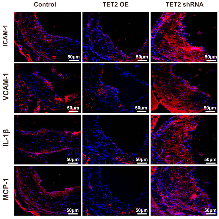 TET2 inhibited inflammation factor expression in the atherosclerotic lesions of high fat-fed ApoE