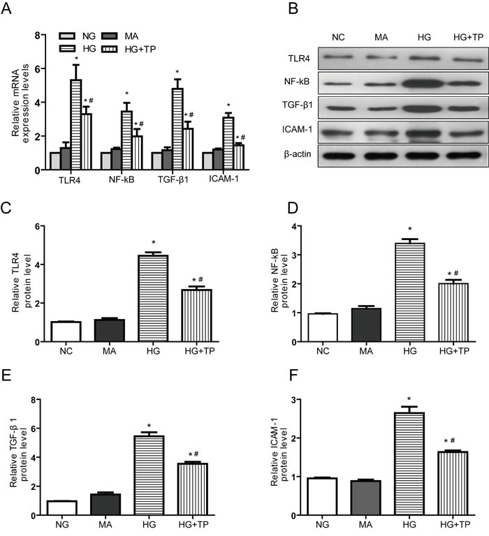 Triptolide reduces the inflammatory responses induced by high glucose concentrations in NRK-52E cells.