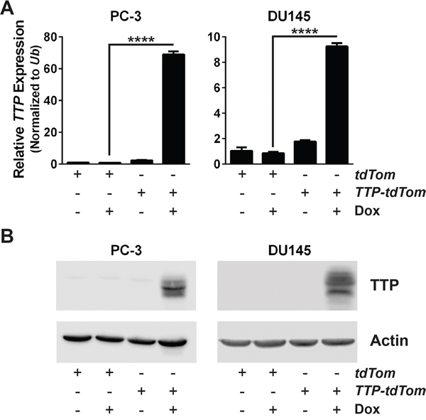 An inducible expression system increases TTP RNA and protein levels in prostate cancer cells.