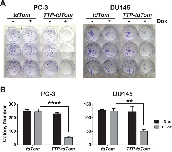 TTP impairs the clonogenic growth of prostate cancer cells.