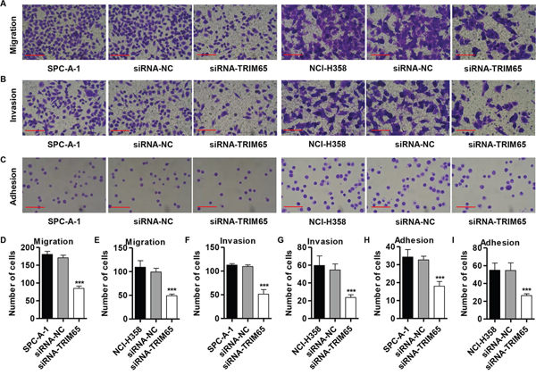Knockdown of TRIM65 inhibits migration, invasion and adhesion in human lung cancer cell lines.