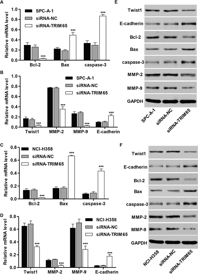 Effect of TRIM65 knockdown on the expression of proteins correlated with apoptosis and migration.