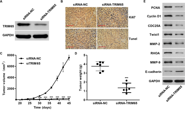 Knockdown of TRIM65 in human lung cancer cells reduces tumor growth in vivo.