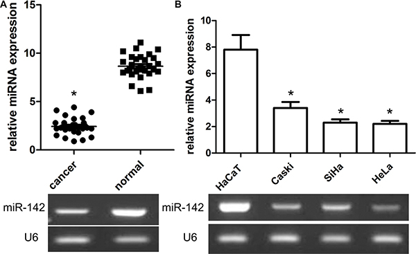 Relative expression of miR-142 in cervical cancer tissues and cell lines as well as its correlation with overall survival of cervical cancer patients.