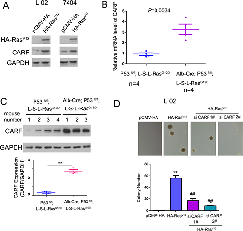 The expression of CARF was induced by oncogenic Ras.