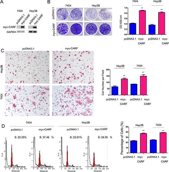 CARF promoted the growth and migration of HCC cells.