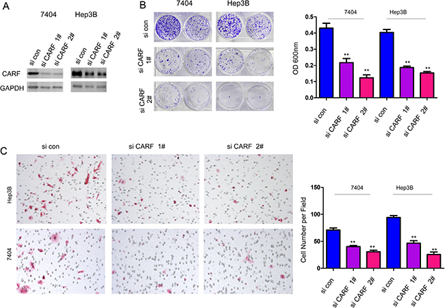 Knocking down the expression of CARF inhibited the growth and migration of HCC cells.
