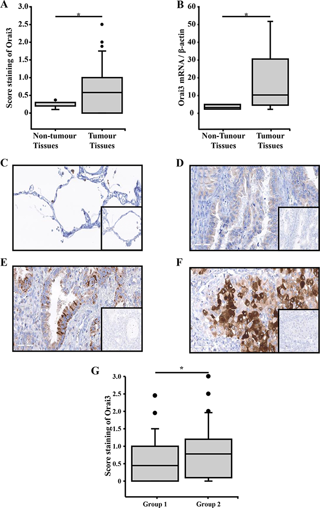 Immunohistochemical stainings of Orai3 in lung adenocarcinoma tissues according to the lung adenocarcinoma classification and relative quantity of Orai3 mRNA in lung adenocarcinoma tissues.