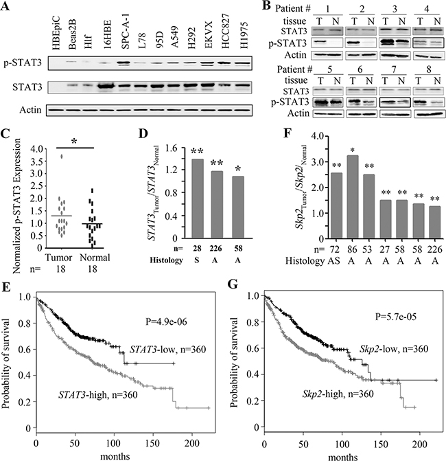 The expression of STAT3 and Skp2 in lung cancer.