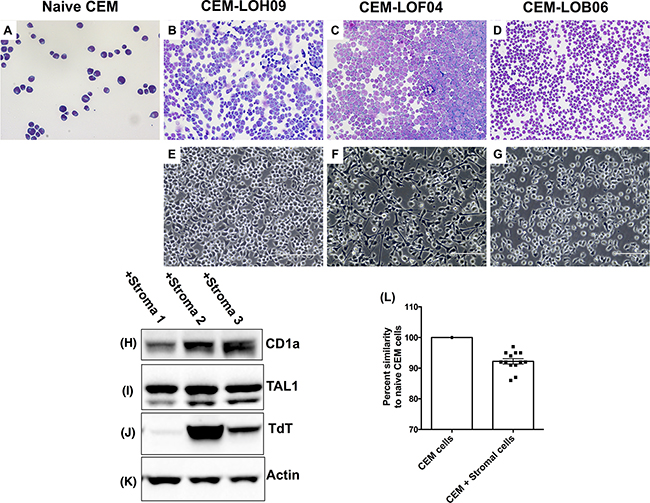 Figure 3. Stromal cells induced phenotypic and genotypic alterations in co-cultured CEM cells.