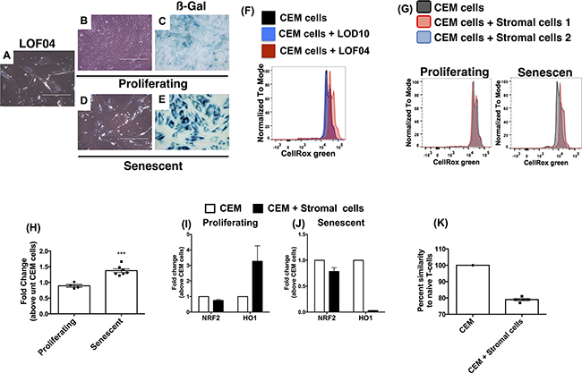 Figure 6. Senescence-induced oxidative stress and impaired antioxidant response account for microsatellite aberrations in CEM-cells co-cultured with lung stromal cells.