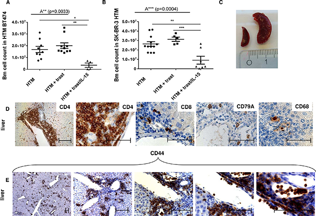 Side effects induced by IL-15 treatment in HTM.