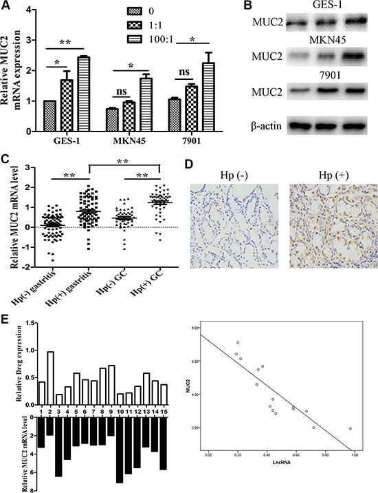 MUC2 expression under H. pylori infected state.