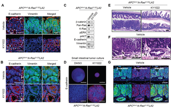 Effects of KY1022 on intra-tumor EMT in the small intestine of ApcMin/+/K-RasG12DLA2 mice.