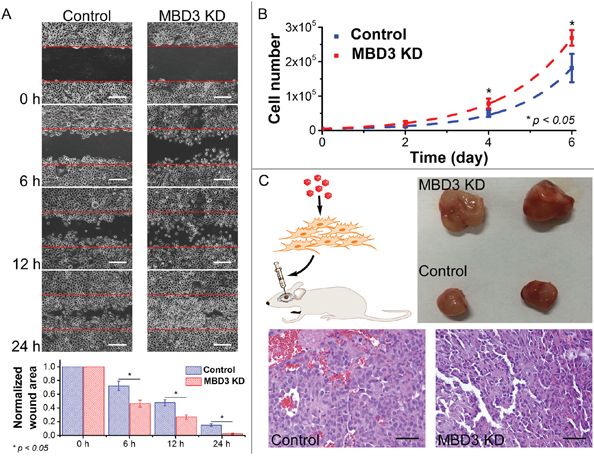 Influence of MBD3 on glioma migration and proliferation.