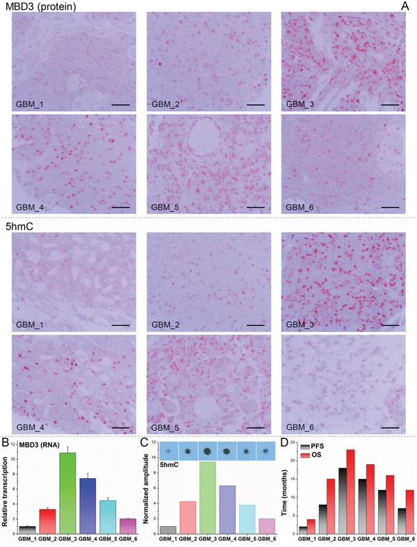 Dual-quantification of MBD3 and 5hmC exerts a promising prognostic power for GBM patients.