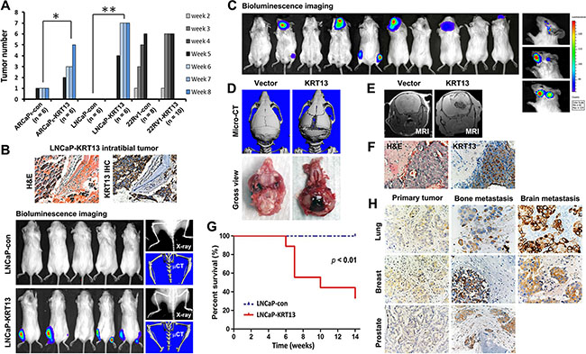 KRT13-overexpression reprograms bone and brain metastases in mice.