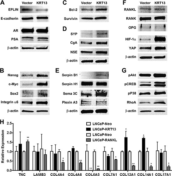 Gene expression profiles of LNCaP-KRT13 with preferential bone- and brain-metastatic potential.