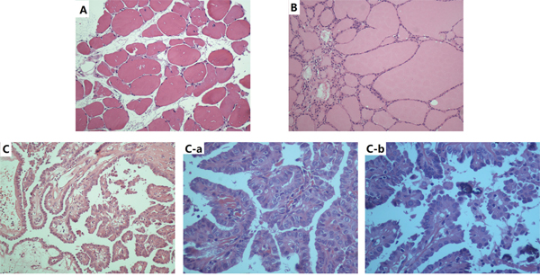 Representative HE-stained sections of thyroid;