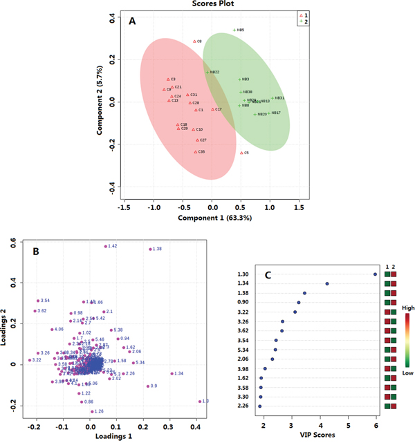 Multivariate data analysis of thyroid tissue metabolomics between PTMC and healthy groups.