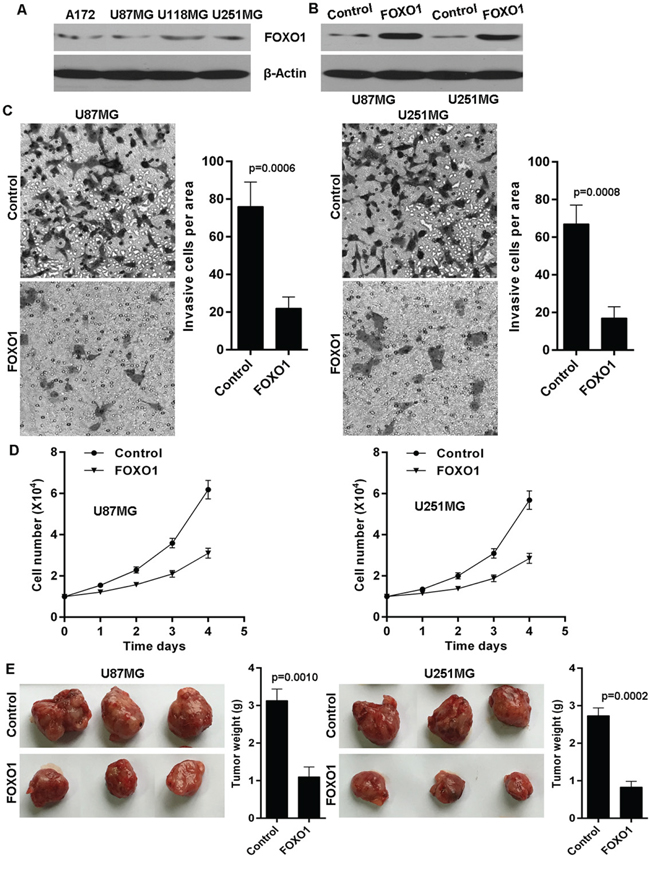 FOXO1 suppresses glioma cells invasion and growth.