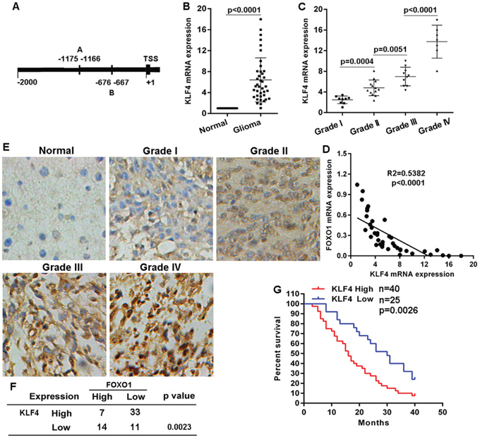 KLF4 negatively correlated with FOXO1 expression in glioma.