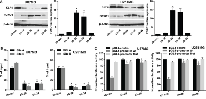 KLF4 transcriptionally represses FOXO1 expression in glioma.