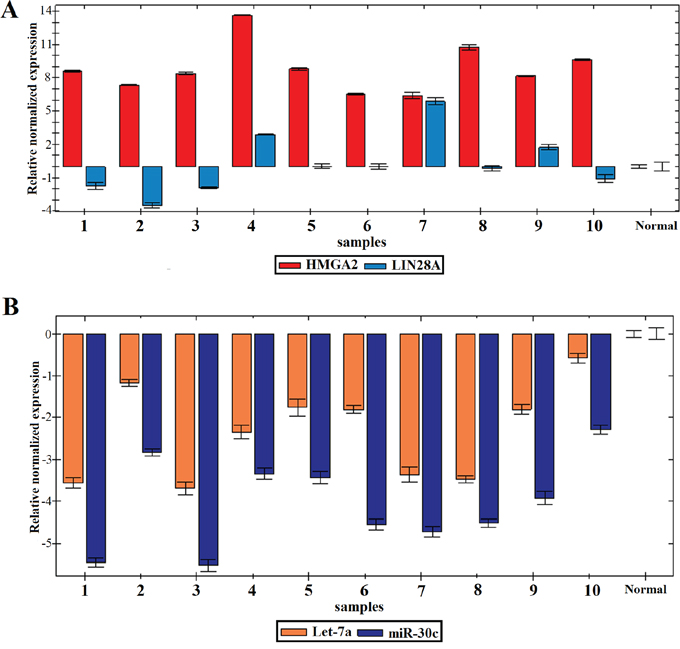 Expression profile of the 10 SCC of the vulva.