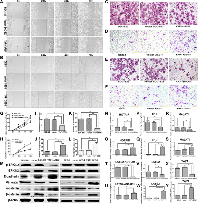 Effects of stable YAP1 silencing in BGC-823 cells and stable YAP1 overexpressing in GES-1 cells on migration and invasion abilities in vitro.