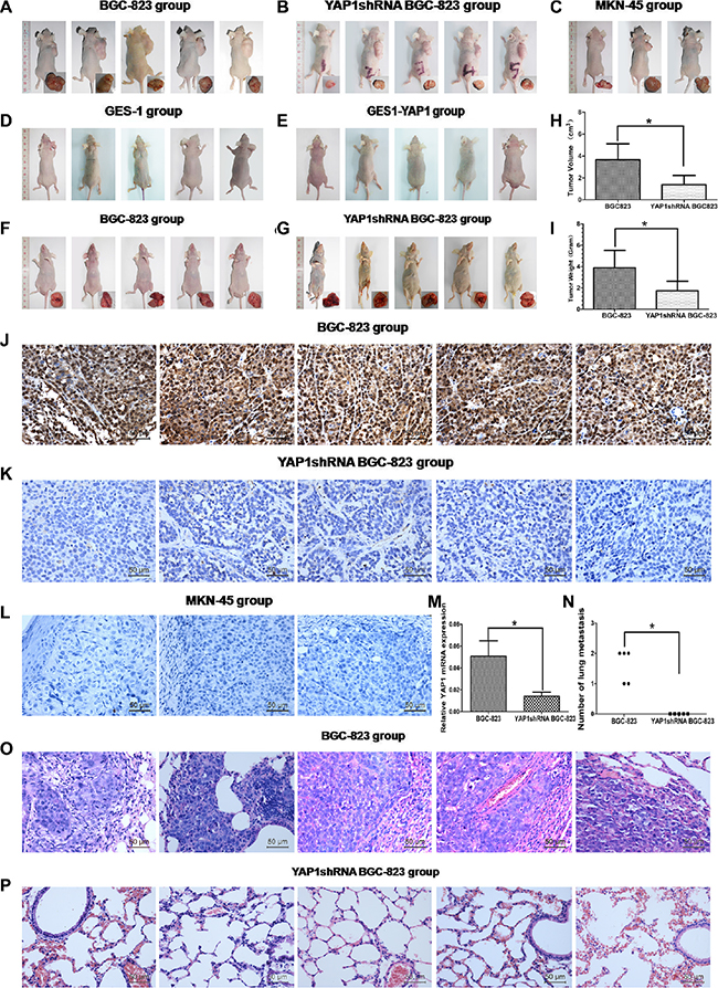 Stable knockdown of YAP1 inhibited xenograft tumor growth and lung metastasis, but YAP1 was not related with tumorigenesis in vivo.