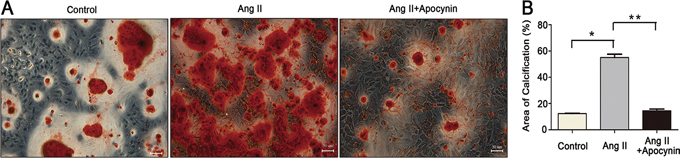 Apocynin attenuated Ang II-induced VSMCs calcification.