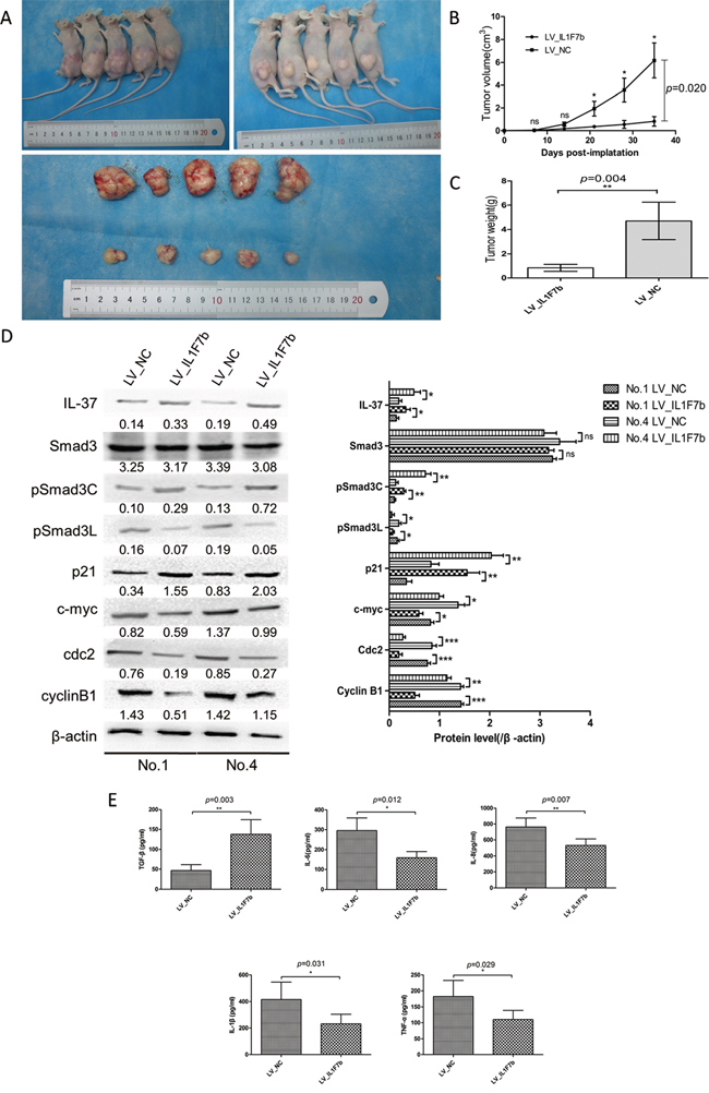 IL-37b suppresses HCC progression in nude mice.